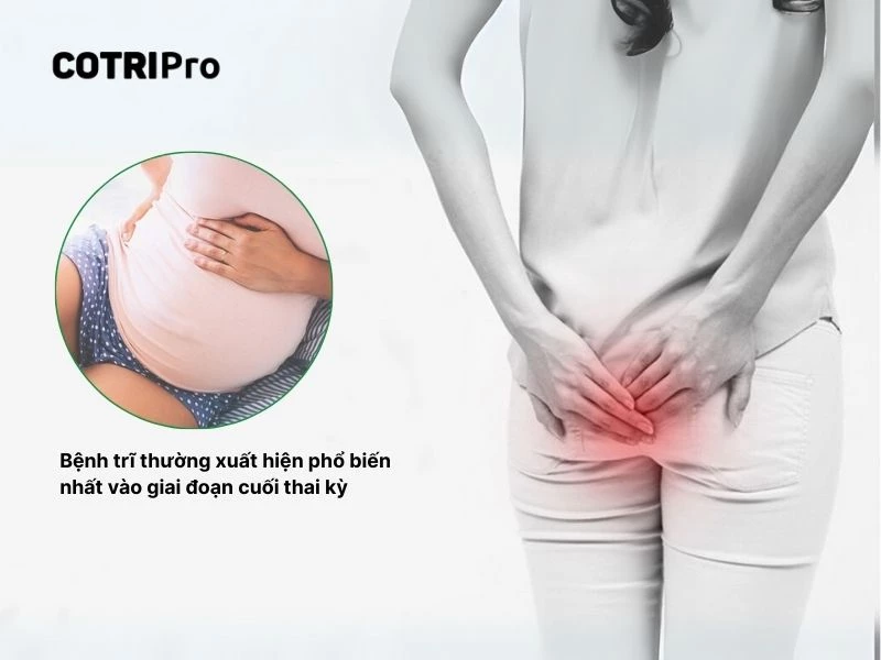 Trĩ thường xuất hiện cuối thai kỳ