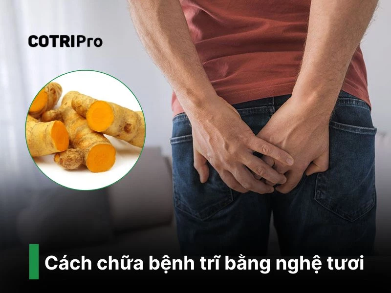 Nghệ chữa bệnh trĩ