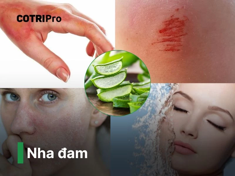 Nha đam thuốc nam chữa bệnh