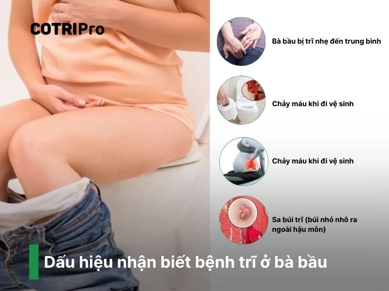 Dấu hiệu bầu bị trĩ