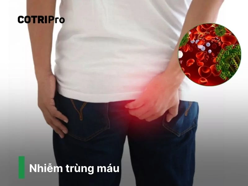 Nhiễm trùng máu bệnh trĩ nguy hiểm