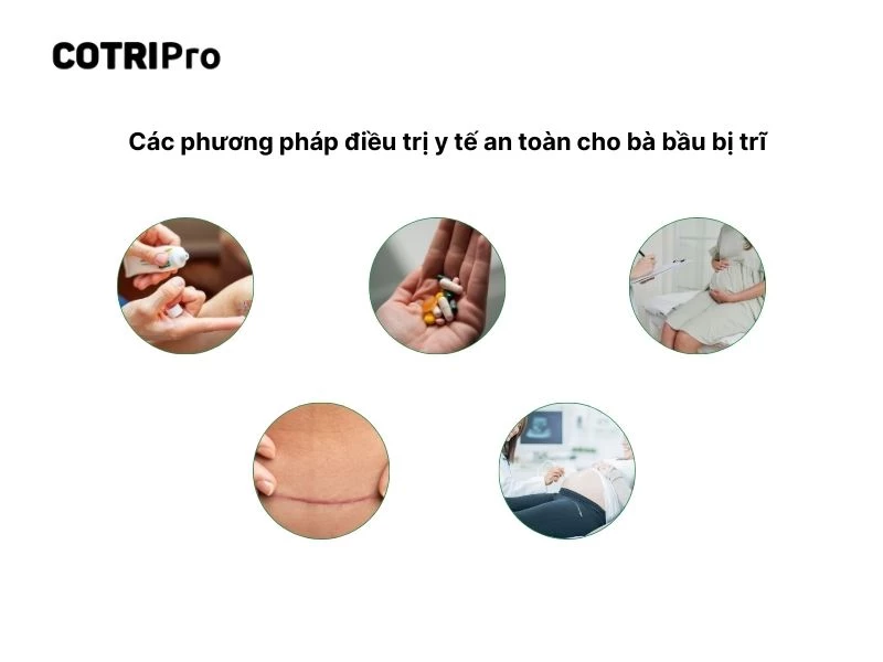Thuốc bôi ngoài da ngừa trĩ