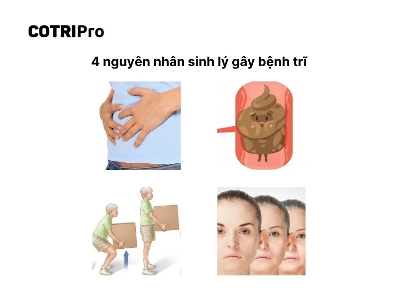 Nguyên nhân sinh lý gây trĩ