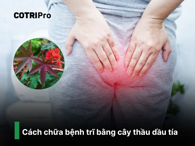 Thầu dầu tía chữa bệnh trĩ
