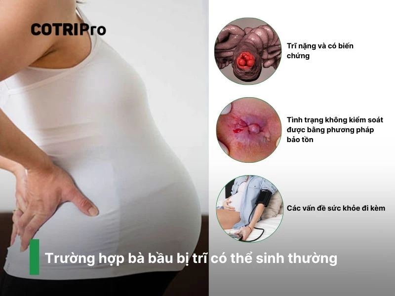 Trĩ nặng nên sinh mổ